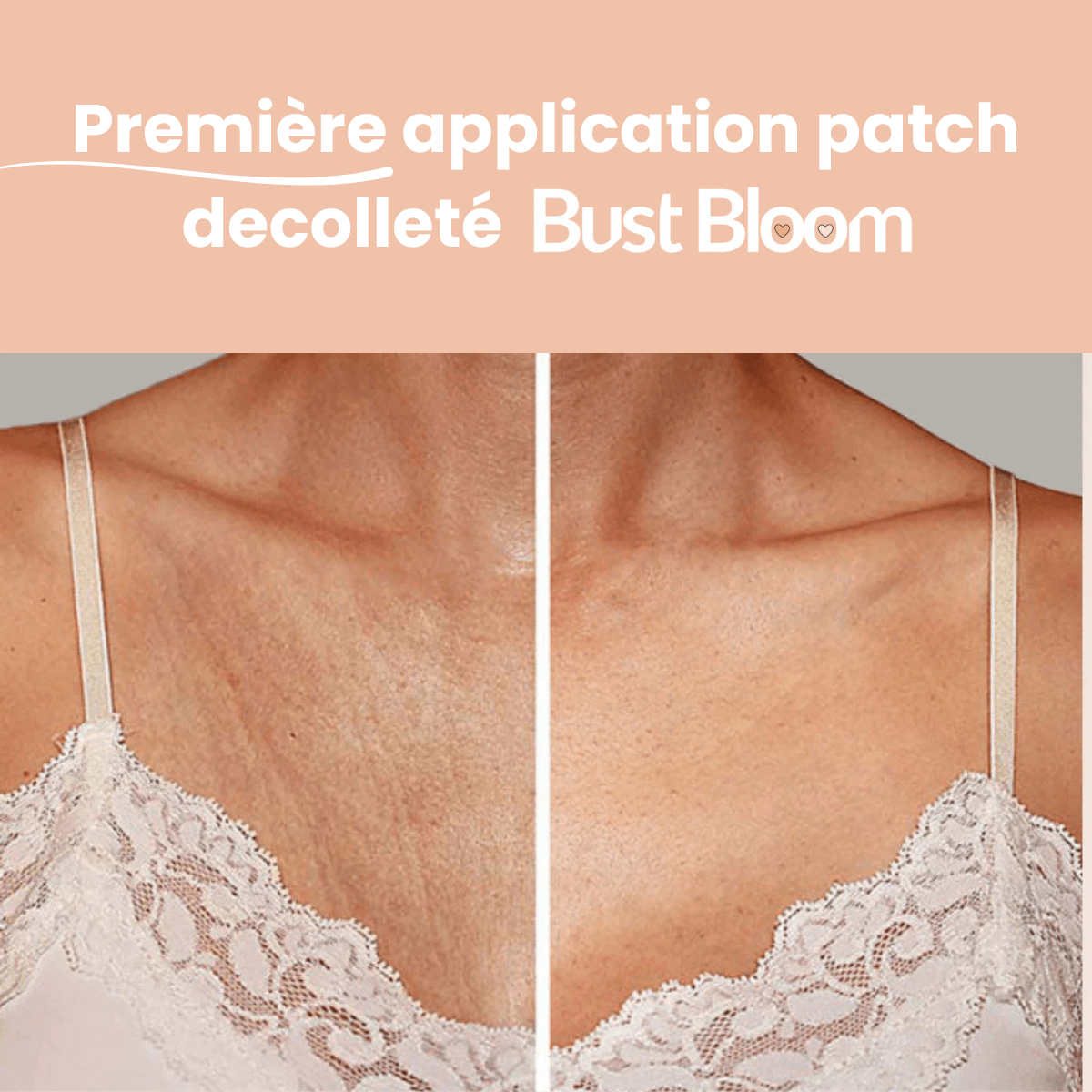 Patch Sublimateur - Bust Bloom