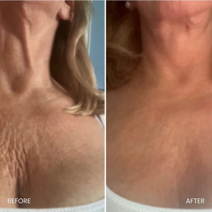 Brassière BustBloom™